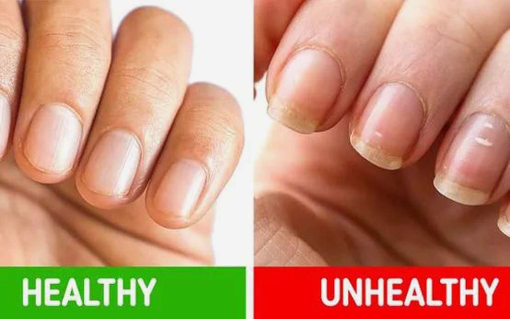 Fingernail 