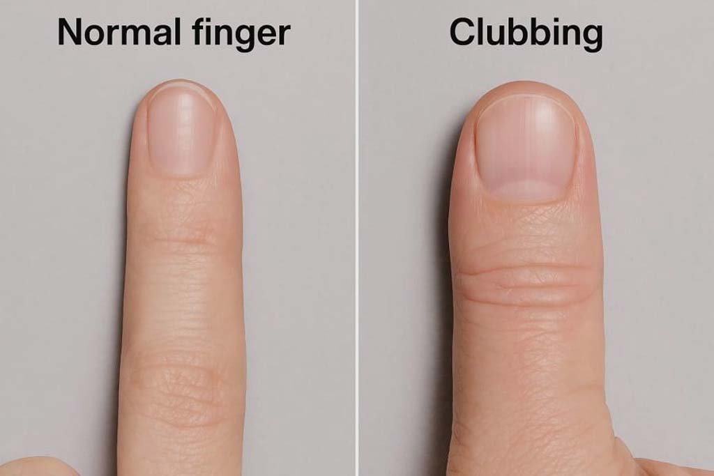 Fingernail 