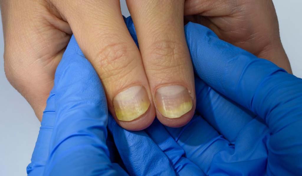 Fingernail 
